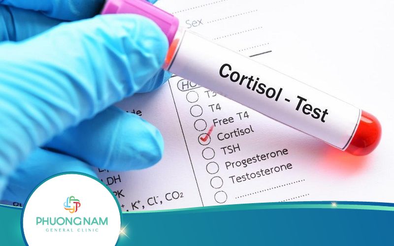 Xét Nghiệm Cortisol Là Gì? Khi Nào Cần Thực Hiện? Xem Ngay!