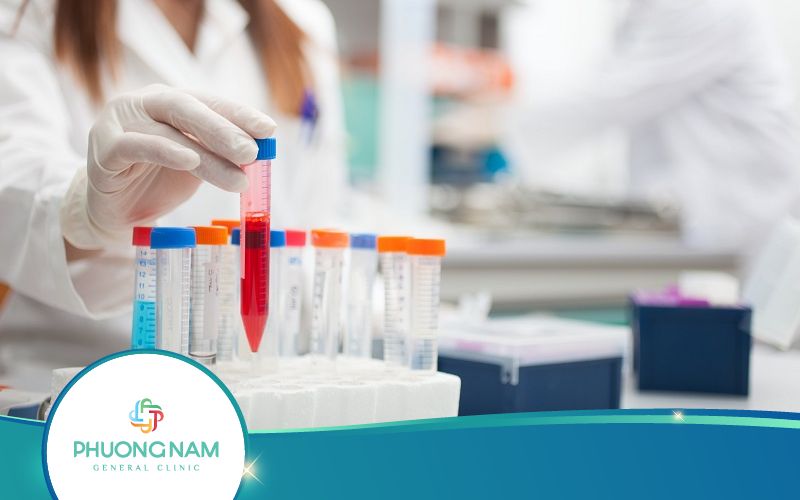 Xét Nghiệm Điện Giải Đồ Là Gì? Khi Nào Cần Thực Hiện?