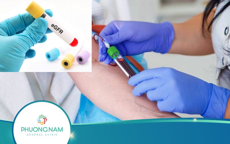 Xét Nghiệm EGFR Được Sử Dụng Khi Nào?