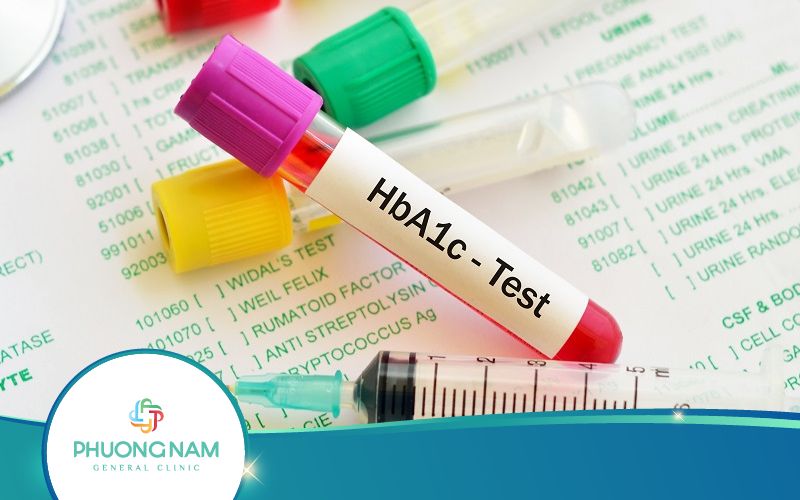 Xét Nghiệm HbA1c Là Gì? Khi Nào Cần Thực Hiện?