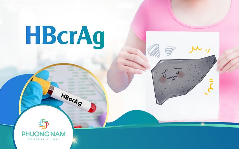 Xét Nghiệm HBcrAg Có Ý Nghĩa Như Thế Nào?