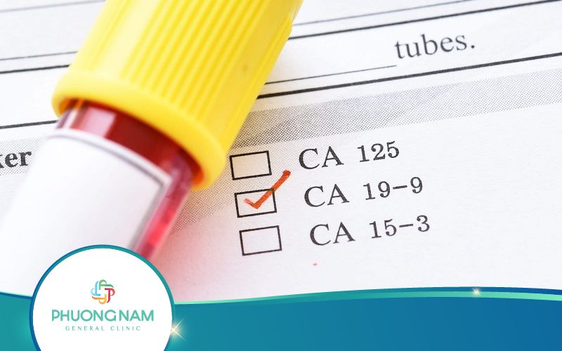 Xét Nghiệm Máu CA 19-9 Để Làm Gì? Thực Hiện Ra Sao?