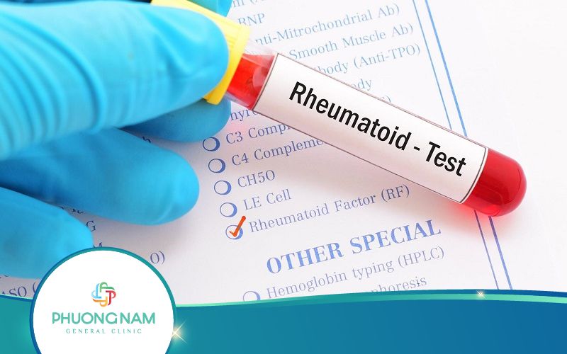 Xét Nghiệm RF Là Gì? Khi Nào Nên Thực Hiện?