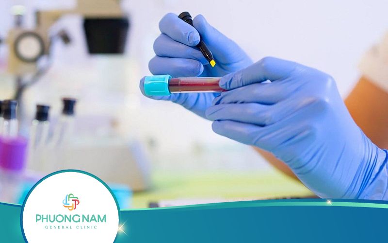 Xét Nghiệm RPR Là Gì? Khi Nào Cần Thực Hiện?
