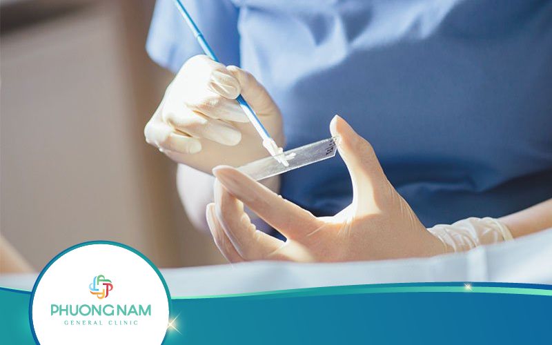 Xét Nghiệm Tế Bào Học Là Gì? Có Ưu Và Nhược Điểm Gì?