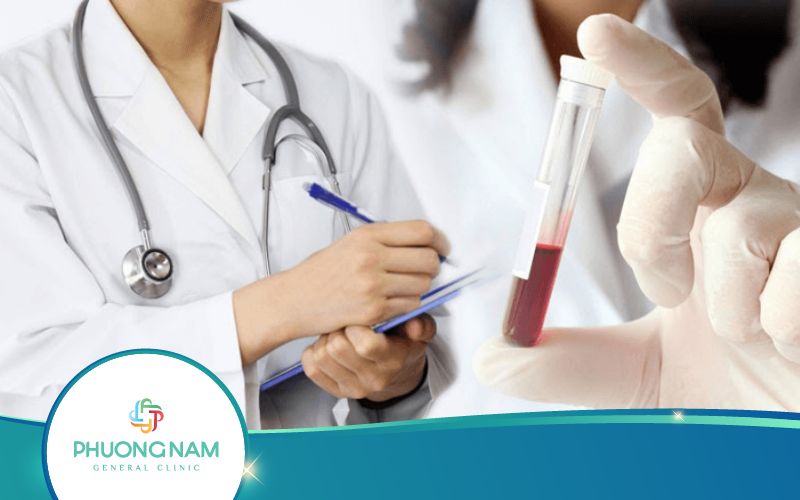 Những Điều Cần Biết Về Xét Nghiệm Transferrin