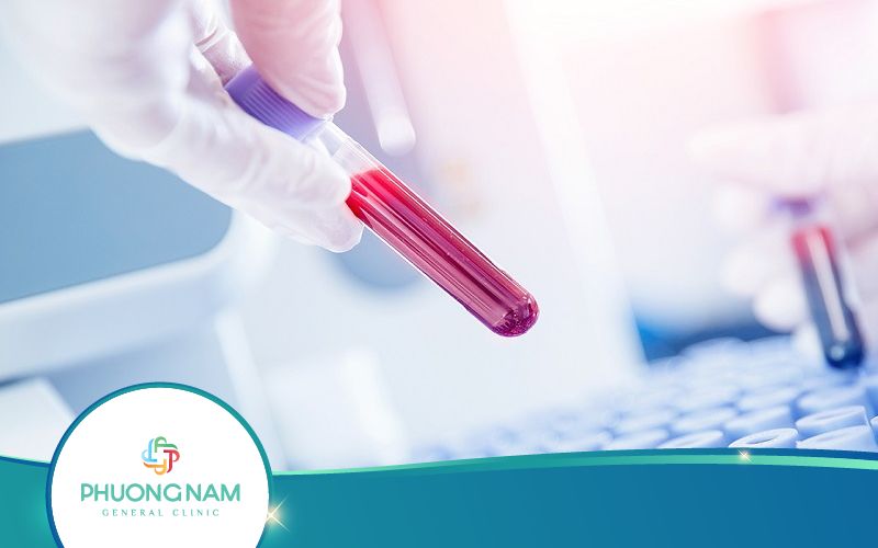 Xét Nghiệm VDRL Là Gì? Quy Trình Thực Hiện Ra Sao?