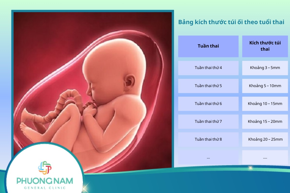 Bảng kích thước túi ối theo tuổi thai và những yếu tố ảnh hưởng