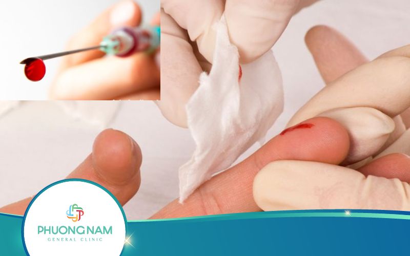 Bị Kim Tiêm Viêm Gan B Đâm Vào Tay Có Nguy Hiểm Không?