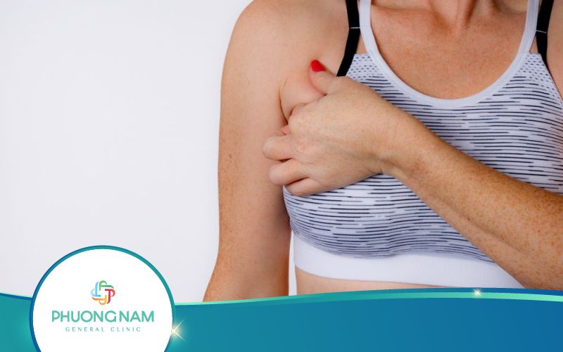Ngứa Nhũ Hoa Trước Kỳ Kinh Nguyệt Phải Điều Trị Thế Nào?