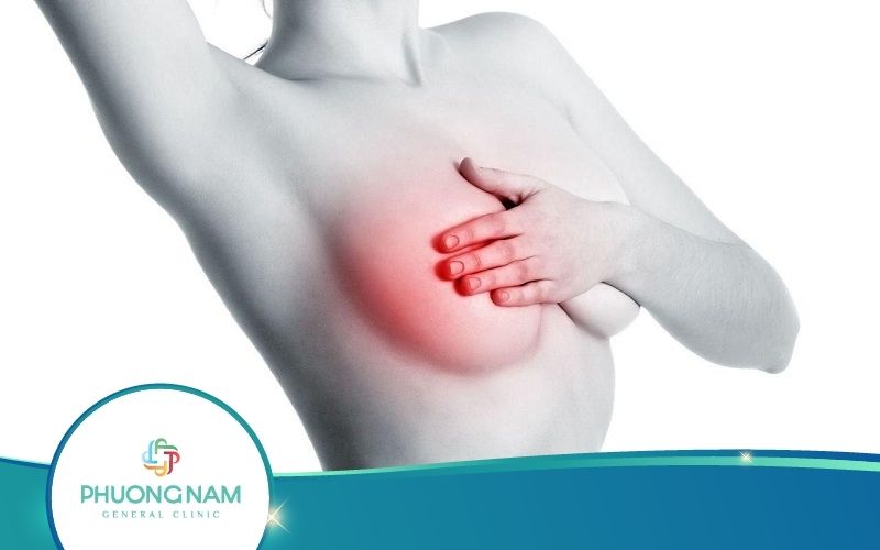 Núm Vú Bị Nứt Phải Điều Trị Như Thế Nào An Toàn Và Hiệu Quả?