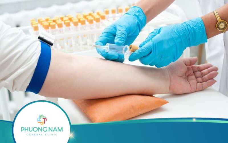 Xét Nghiệm Chì Trong Máu Là Gì? Thực Hiện Thế Nào?