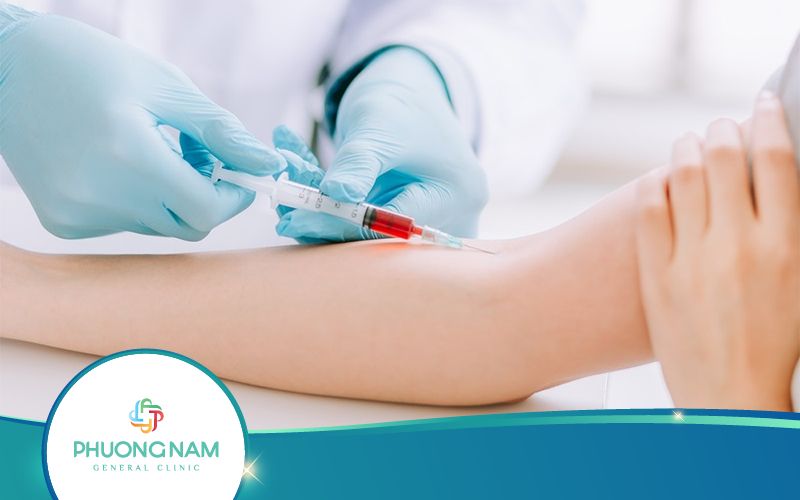 Xét Nghiệm Nồng Độ Cồn Trong Máu Là Gì?