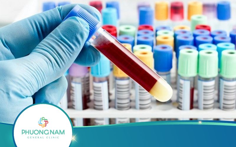 Xét Nghiệm Thời Gian Máu Chảy Diễn Ra Như Thế Nào?