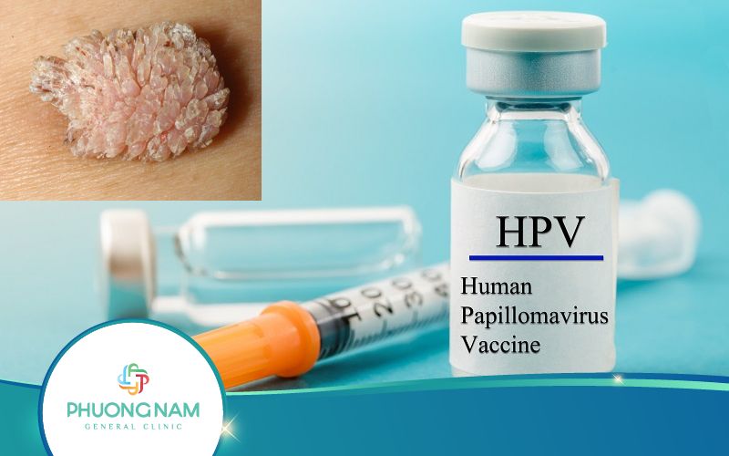 [Giải Đáp] Bị Sùi Mào Gà Có Tiêm Phòng HPV Được Không?