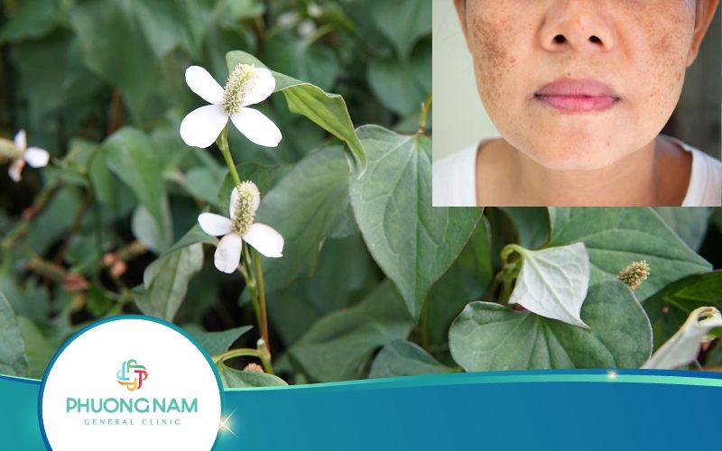 Làm Nước Rau Diếp Cá Luộc Trị Nám, Tàn Nhang Như Thế Nào?