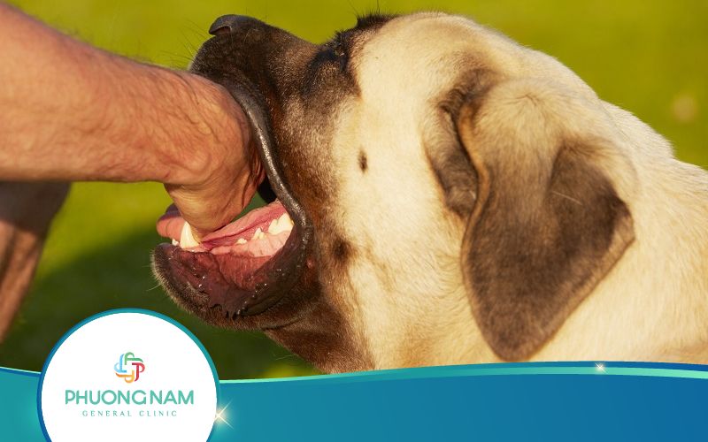 Bệnh Dại Lây Qua Đường Nào? Khi Nào Cần Tiêm Ngừa Dại?