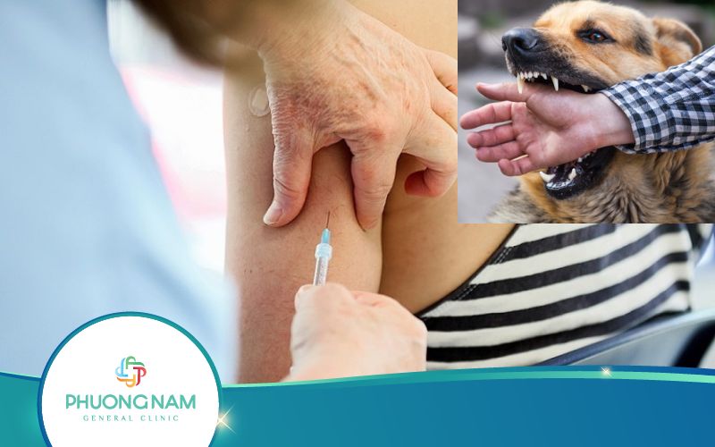 Người Đã Tiêm Phòng Dại Bị Chó Cắn Có Cần Tiêm Tiếp Không?
