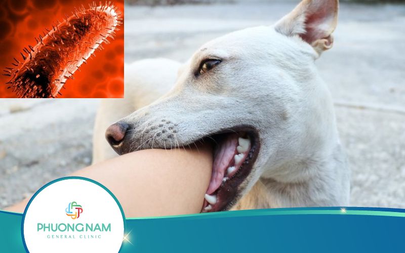 Bệnh Dại – Xem Tất Tần Tật Các Thông Tin Ở Đây!