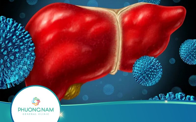 Viêm Gan B Có Nguy Hiểm Không? Điều Trị Thế Nào?