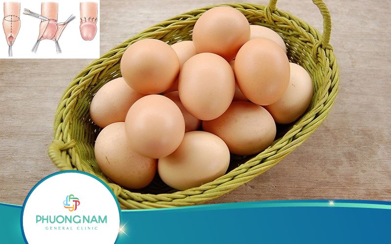 Sau Khi Cắt Bao Quy Đầu Ăn Trứng Được Không?