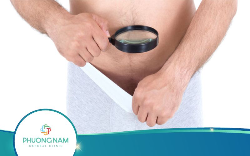 Có Nên Mặc Quần Lót Sau Khi Cắt Bao Quy Đầu Không?