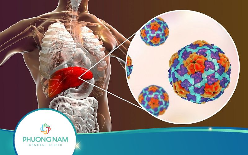 Bệnh Viêm Gan B Mạn Tính Có Chữa Khỏi Được Không?