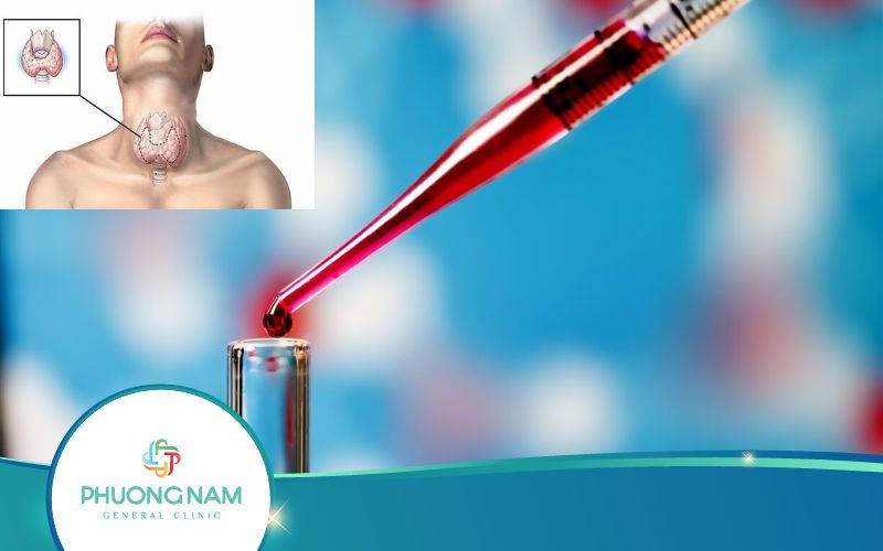 Tổng Hợp Các Chỉ Số Xét Nghiệm Ung Thư Tuyến Giáp Quan Trọng