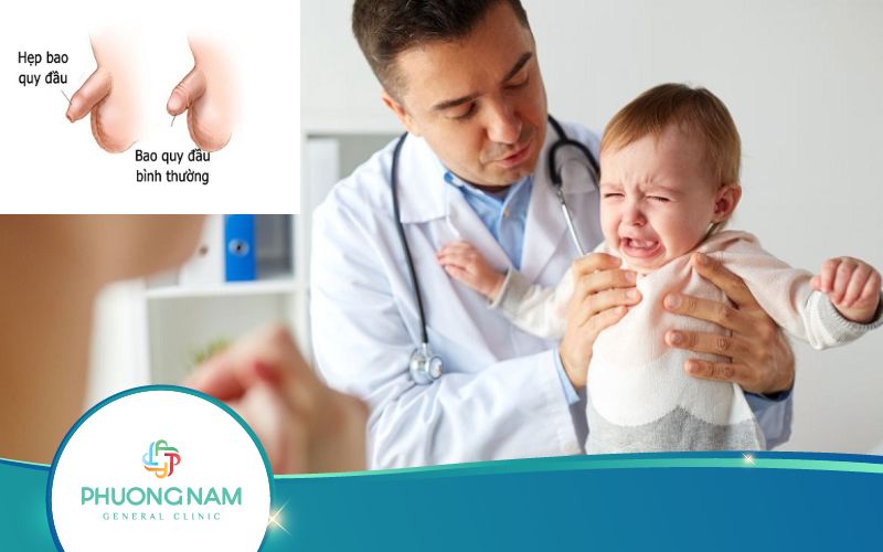 Hẹp Bao Quy Đầu Ở Trẻ 4 Tháng Tuổi Có Sao Không?
