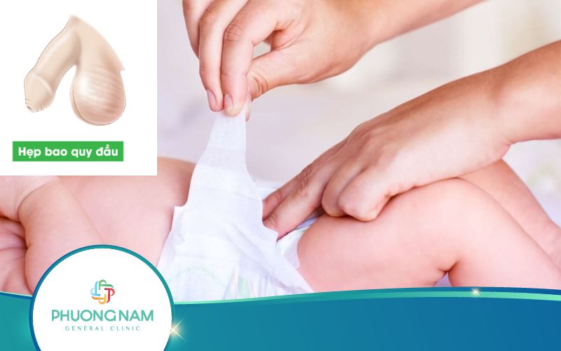 Hẹp Bao Quy Đầu Ở Trẻ Có Nguy Hiểm Không? Giải Đáp Ngay!