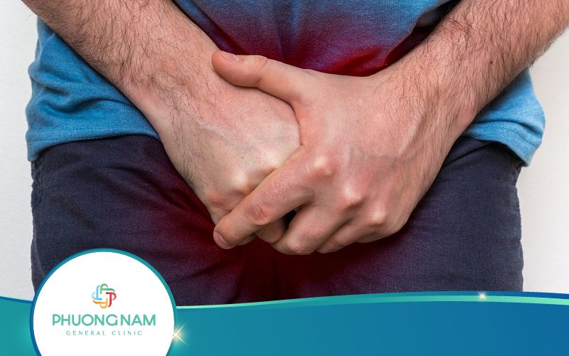 Nổi Hạch Sau Khi Cắt Bao Quy Đầu Có Sao Không?