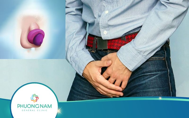 Sau Khi Cắt Bao Quy Đầu Bị Bầm Tím Có Sao Không?
