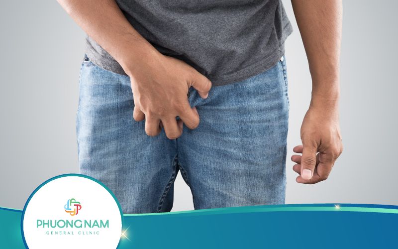 Sau Khi Cắt Bao Quy Đầu Bị Ngứa Nguyên Nhân Do Đâu?