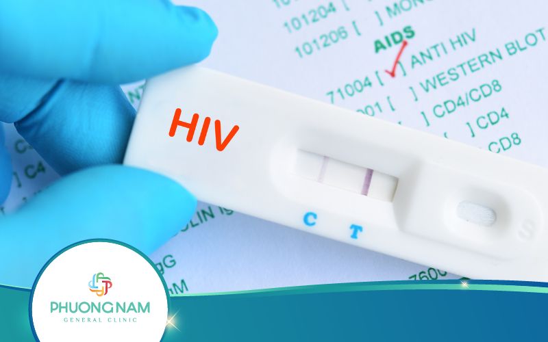 Xét Nghiệm Anti HIV Là Gì? Có Chính Xác Không?