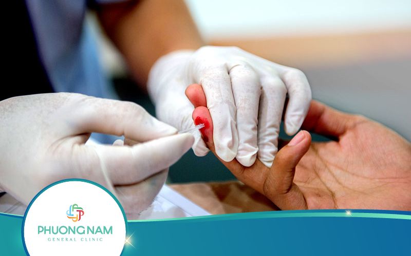 Xét Nghiệm HIV AB Test Nhanh Có Chính Xác Không?