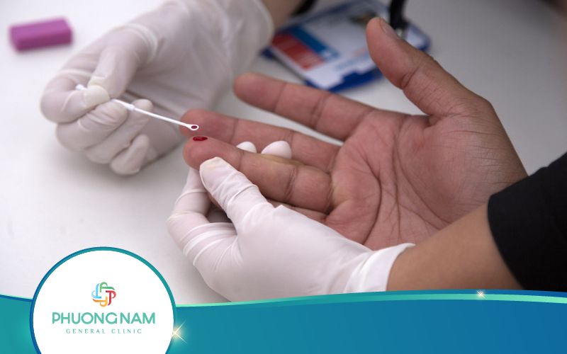 Xét Nghiệm HIV Ag/Ab Combo Và Những Điều Cần Biết!