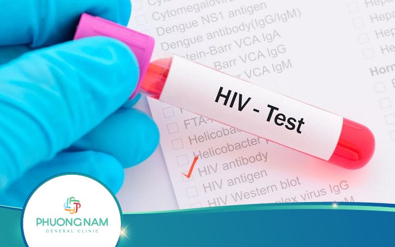 Giải Đáp: Xét Nghiệm HIV Bao Lâu Có Kết Quả?