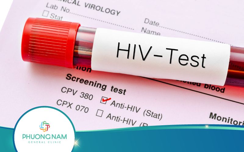 Góc Giải Đáp: Xét Nghiệm HIV Có Bị Sai Kết Quả Không?
