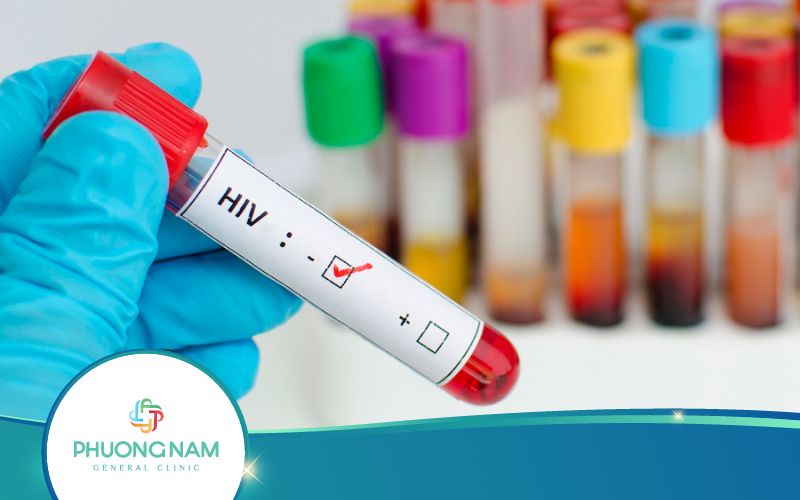 Xét Nghiệm Khẳng Định HIV Là Gì? Tìm Hiểu Ngay!!!
