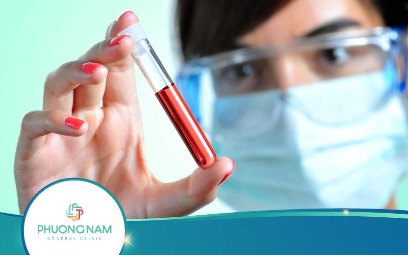 Xét Nghiệm Máu Bình Thường Có Phát Hiện Ra HIV Không?