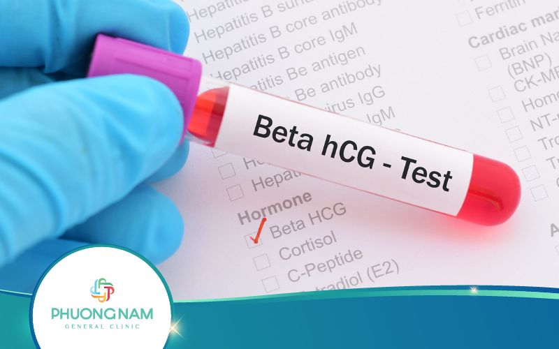 Xét Nghiệm Máu Có Thai Nhưng Siêu Âm Không Thấy Do Đâu?