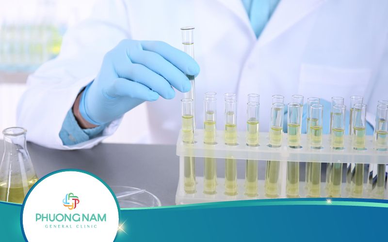 Xét Nghiệm Nước Tiểu Có Phát Hiện HIV Không? Vì Sao?