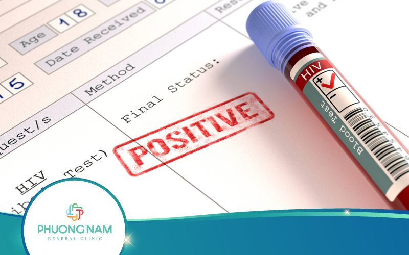 Xét Nghiệm PCR HIV Và Những Điều Cần Biết