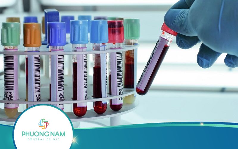 Xét Nghiệm Tải Lượng Virus HIV Là Gì? Đọc Kết Quả Thế Nào?