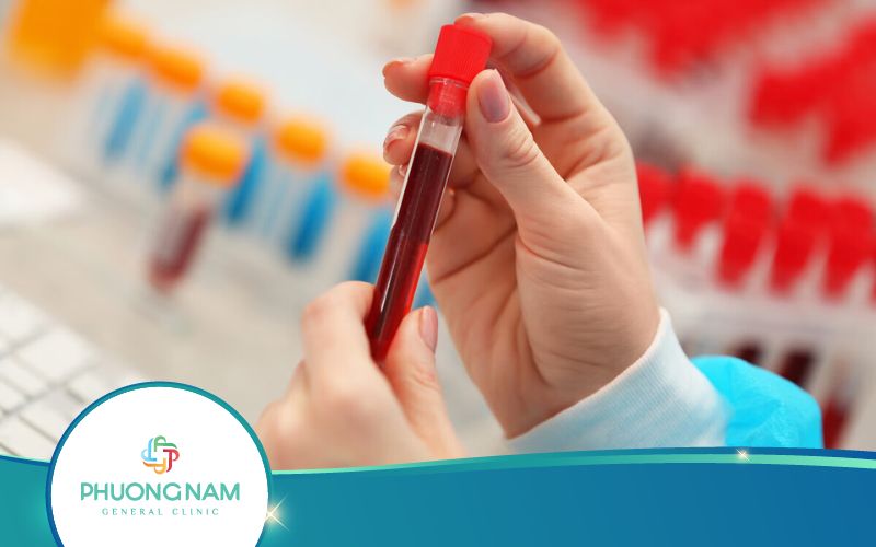 Xét Nghiệm Thiếu Máu Và Những Điều Cần Biết