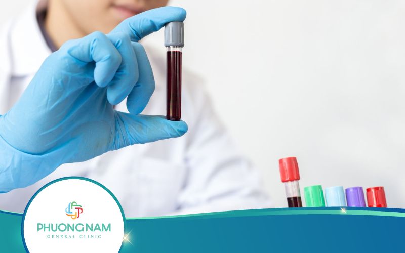 Giải Đáp: Xét Nghiệm Viêm Gan B Có Phát Hiện HIV Không?