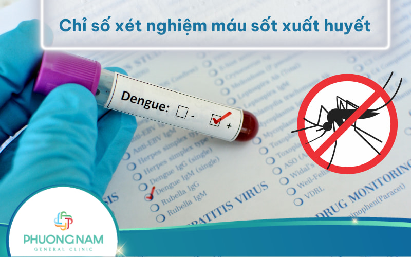 Cách Đọc Chỉ Số Xét Nghiệm Máu Sốt Xuất Huyết Từ Chuyên Gia