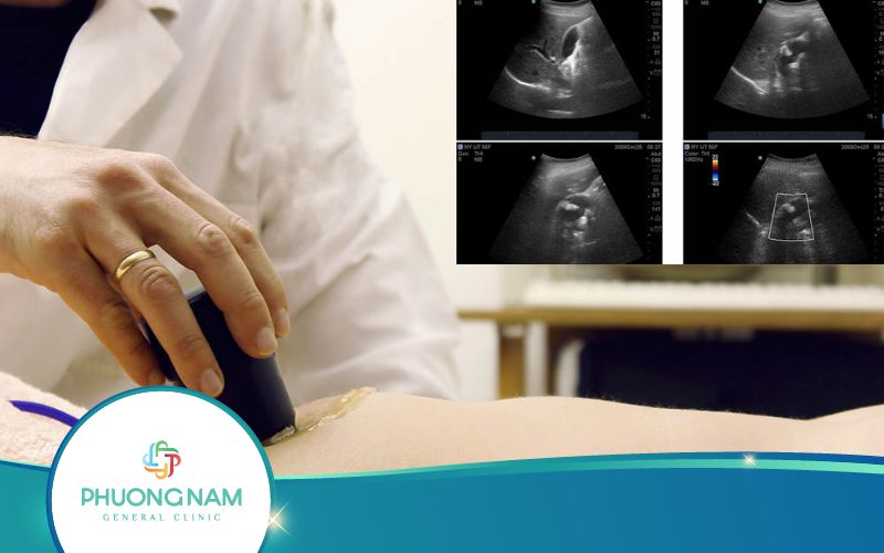 Làm Sao Biết Được Kết Quả Siêu Âm Ổ Bụng Bình Thường?