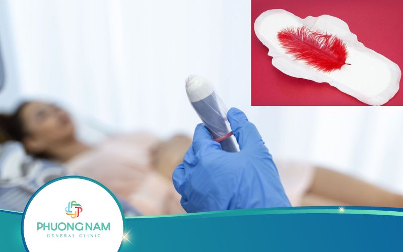Siêu Âm Đầu Dò Bị Ra Máu Có Sao Không?