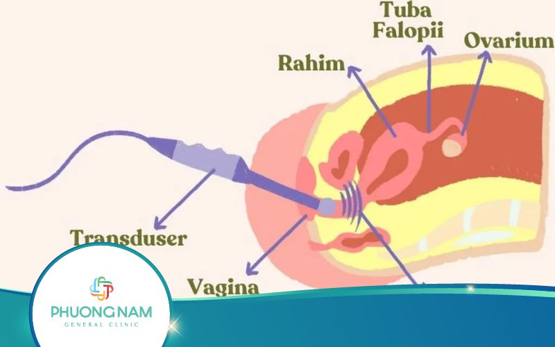 Siêu Âm Đầu Dò Có Chính Xác Không? Có Gây Hại Cho Sức Khỏe?